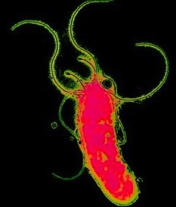Helicobacter
pylori bacterium