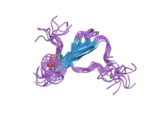 PD-Tau-protein-300x225.jpg