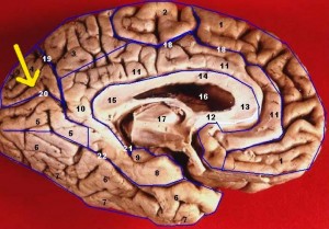 Human_brain_inferior-medial_view_description_2_-_calcarine_sulcus