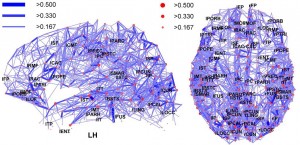 1024px-Network_representation_of_brain_connectivity