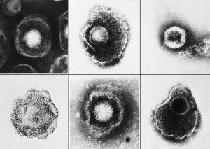 1024px-Herpesviridae_EM_PHIL_2171_lores