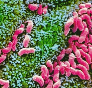 crop Bacteria in ulcer in stomach