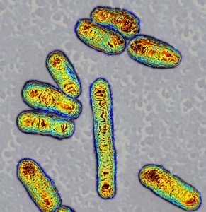 Escherichia coli bacteria,TEM