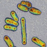 Escherichia coli bacteria,TEM