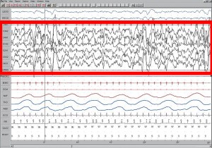 Sleep_EEG_Stage_4