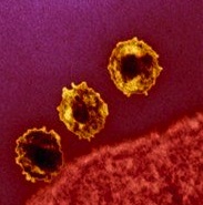Cell infected with HIV, TEM