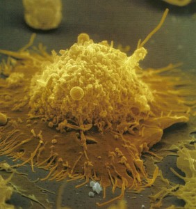 B lymphocyte Memory cell