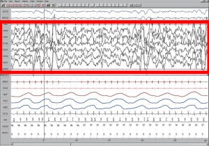 800px-Sleep_EEG_Stage_4
