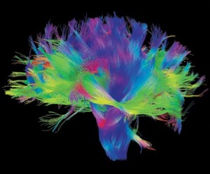 Colorful brain fibers