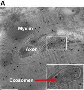 exosomes 1