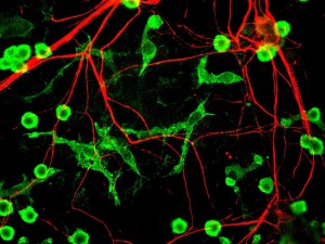 800px-Microglia_and_neurons