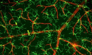 MG scan for synapses