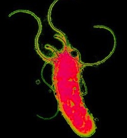 Helicobacter pylori bacterium