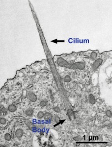 neuron cilium autism