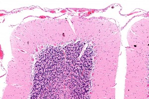 Nephron 1024px-Cerebellar_cortex_-_intermed_mag