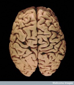 B0005749 Human brain from above