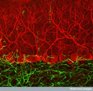 B0006224 Purkinje cells in the cerebellum