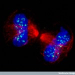 B0004328 Human chromosomes and spindle at anaphase