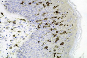 PD  Langerhans cells in dermis 800px-Dendritic_cells