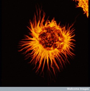 B0002342 Actin (red) in astrocyte cytoskeleton