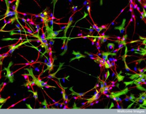 B0006511 Neurons and astrocytes from neural stem cells