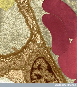 B0004601 Glomerular capillaries and podocyte