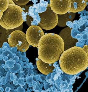PD  BEAUTIFUL  640px-Staphylococcus_aureus_bacteria_escape