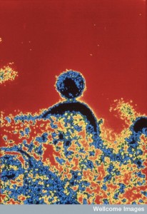 N0012660 HIV virus, budding from T lymphocyte