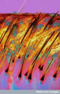 B0007565 Human scalp