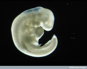 B0001401 Four week old human embryo - pair with B1402