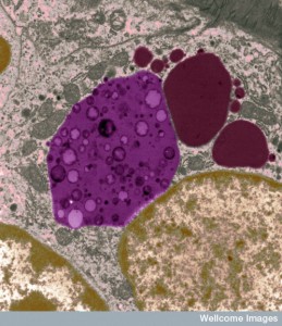 B0004611 Phagocytic vesicle and lysosomes inside a macrophage