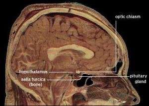 PD hypothalamus