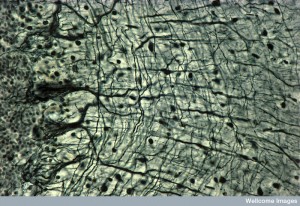 B0004433 Transverse section of human cerebellum, LM silver-stained