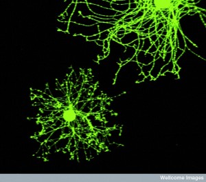 B0001895 sensory neurons from an adult DRG