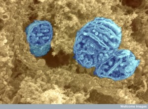 B0003650 Three mitochondria surrounded by cytoplasm