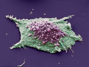 WC   Lung_cancer_cell_larger
