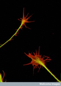 B0003229 Dorsal Root Ganglion neuron growth cones