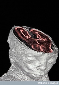 B0001014 Foetal MRI scan