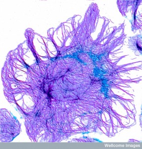 B0002682 Fibroblast showing actin cytoskeleton - purp