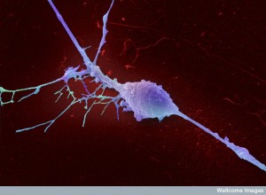 B0006918 Retinal ganglion cell