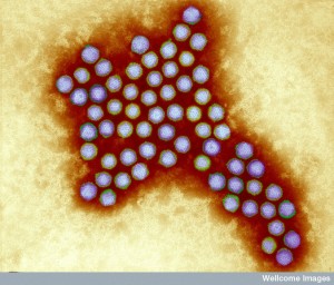 B0003222 Adenovirus, coloured electron micrograph
