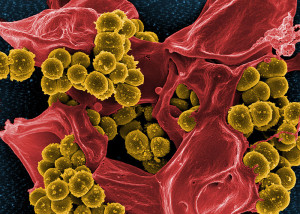 Jacopo Werther WIK  BEAUTIFUL  800px-Scanning_electron_micrograph_of_Methicillin-resistant_Staphylococcus_aureus_(MRSA)_and_a_dead_Human_neutrophil_-_NIAID