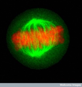 B0005012 Human cell in metaphase