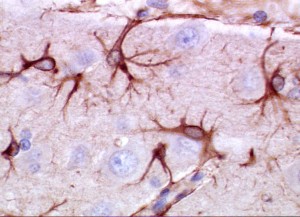 PD  Active Astrocytes  good colorful pic