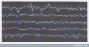 N0027711 Diagramatic representation of brain waves Credit: Miles Kelly Art Library. Wellcome Images images@wellcome.ac.uk http://wellcomeimages.org Diagramatic representation of brain waves - eeg trace Digital artwork Published: - Copyrighted work available under Creative Commons by-nc-nd 4.0, see http://wellcomeimages.org/indexplus/page/Prices.html
