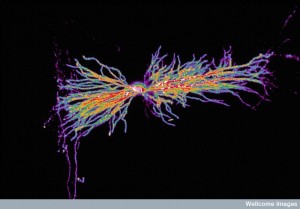 B0000503 Interneuron in hippocampus Credit: Biosciences Imaging Gp, Soton. Wellcome Images images@wellcome.ac.uk http://wellcomeimages.org An interneuron in the hippocampus, computer-coloured. Published: - Copyrighted work available under Creative Commons by-nc-nd 4.0, see http://wellcomeimages.org/indexplus/page/Prices.html