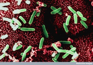 B0003412 Clostridium on gut lining - coloured