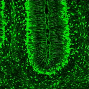 PD     Bergmann_Glia