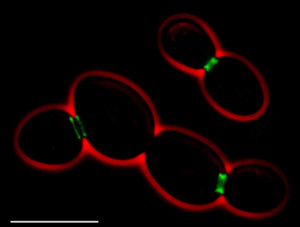 PD septins are green cells red cerevisiae_septins