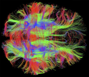 WC Nerve_fibres_in_a_healthy_adult_human_brain,_MRI_larger